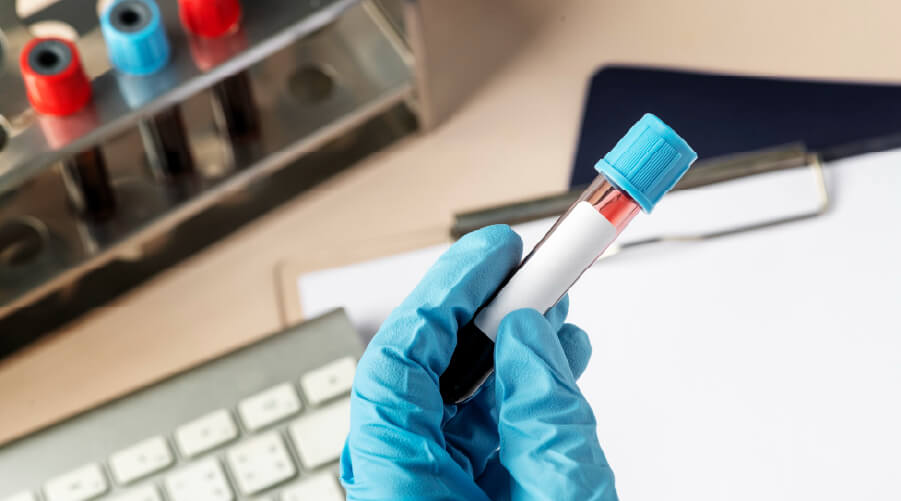 Hetapitis C - imagen.jpg